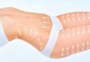 La cryolipolyse, la méthode naturelle contre la culotte de cheval ! La cryolipolyse, la méthode naturelle contre la culotte de cheval !