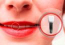 Les complications possibles après la pose d’implant dentaire : ce que vous devez savoir Les complications possible après la pose d'implant dentaire