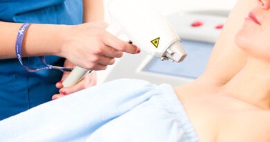 épilation laser réussie