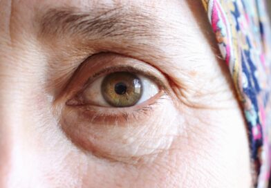 Comment traiter les paupières tombantes ? Gros plan sur les paupières d'une femme mature présentant un relâchement cutané.