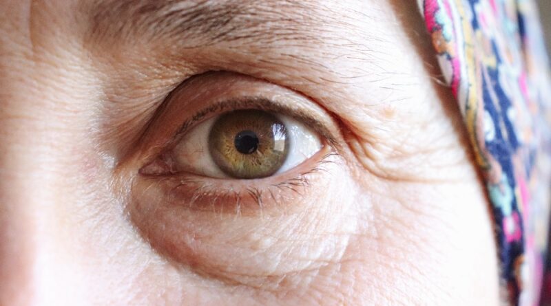 Gros plan sur les paupières d'une femme mature présentant un relâchement cutané.